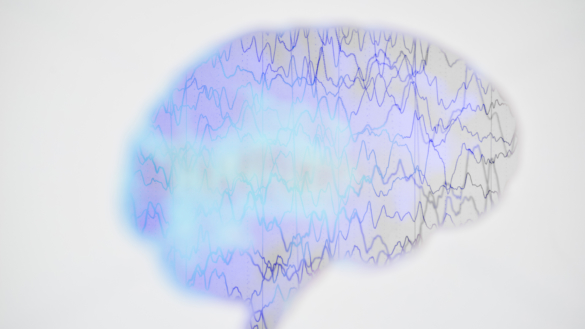 Epilepsivården får nationella riktlinjer